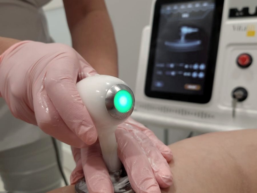 Vitalift, zabieg ujędrniający na twarz lub ciało w Laser Clinic Radom